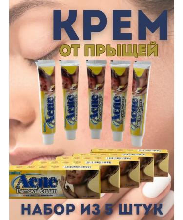 Kamielli Acne removal cream for pimples for problem skin