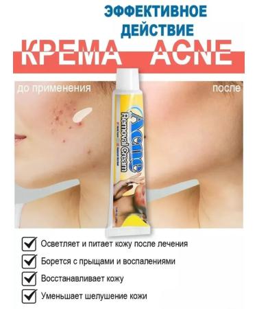 Kamielli Acne removal cream for pimples for problem skin - Buy Online on GoSupps.com