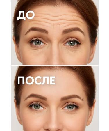 THEON Paths for the forehead from wrinkles anti -aging care smooth skin - Buy Online on GoSupps.com