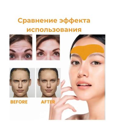 AZHAR Paths from wrinkles on the forehead set of 5 pcs - Buy Online on GoSupps.com