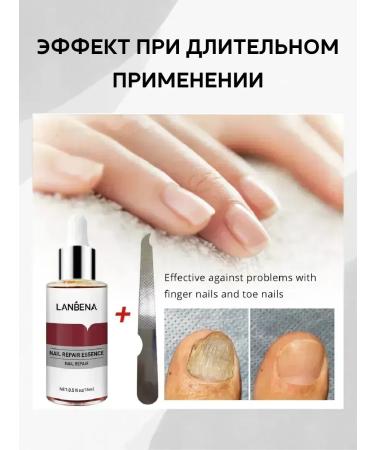 CosmoDi Essence against nail fungus - Buy Online on GoSupps.com