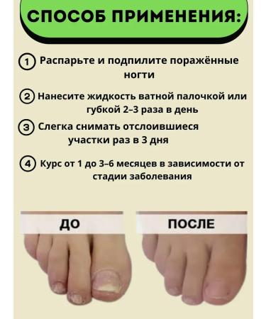 I'll take it Effective Chinese drug for nail fungus - Buy Online on GoSupps.com
