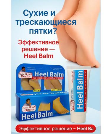 zozo Cream from cracks on heels