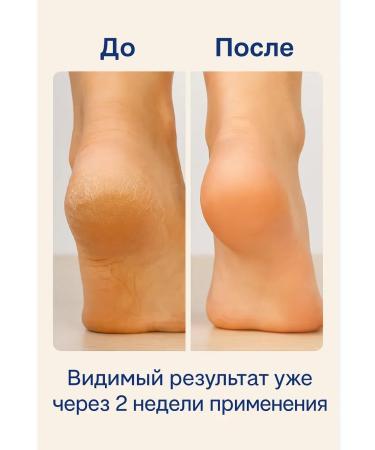 zozo Cream from cracks on heels - Buy Online on GoSupps.com