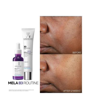 B3 Essence Dark Spots corrector