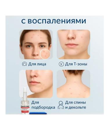 MER25 Acne acne agent from irritation - Buy Online on GoSupps.com