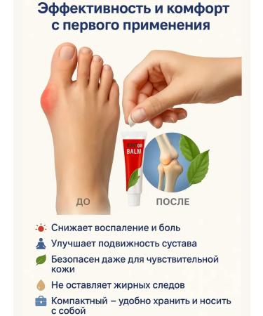 Zhyldyz Therapeutic balm against valgus deformation - Buy Online on GoSupps.com