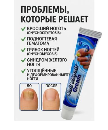 Teon Nail restoration cream antifungal - Buy Online on GoSupps.com