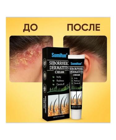 Teon Cream from seborrheic dermatitis from itching - Buy Online on GoSupps.com
