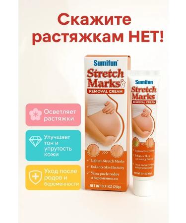 mubi123 Cream from stretch marks on the stomach after childbirth