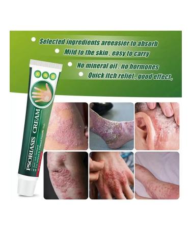 Topic remedy for the treatment of psoriasis and dermatophytes - Buy Online on GoSupps.com