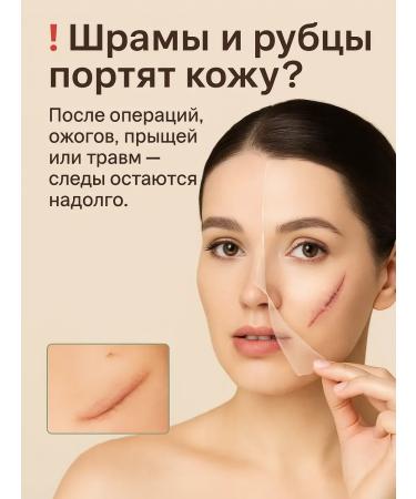Asya Mir Gel from scars - Buy Online on GoSupps.com