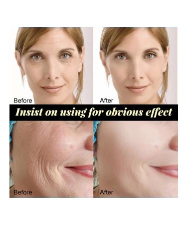 Eelhoe collagen thread lifting from wrinkles 3 pcs - Buy Online on GoSupps.com