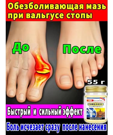 Ointment with valgus deformation of the painting bone 55 g