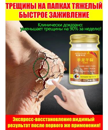 Cream from cracks on heels healing with urea