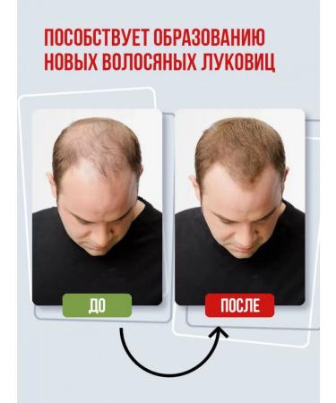 MAGNATE Shampoo for growth and restoration of hair with onions of 400 ml - Buy Online on GoSupps.com
