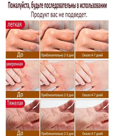 Cream for the legs with urea from cracks - Buy Online on GoSupps.com