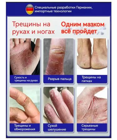 Feet cream with urea from cracks and corns 50g - Buy Online on GoSupps.com