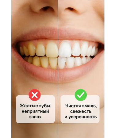 RK3110 Whitening toothpaste - Buy Online on GoSupps.com