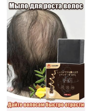 Solid shampoo for hair growth and against hair loss