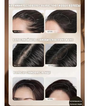 Solid shampoo for hair growth and against hair loss - Buy Online on GoSupps.com