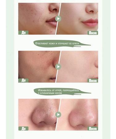 Mask Mask from black dots of acne purification pores 50 g - Buy Online on GoSupps.com