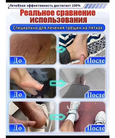 Cream from cracks on the heels healing 100r - Buy Online on GoSupps.com