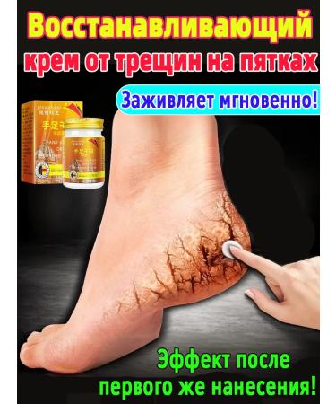 Cream from cracks on heels healing 150r