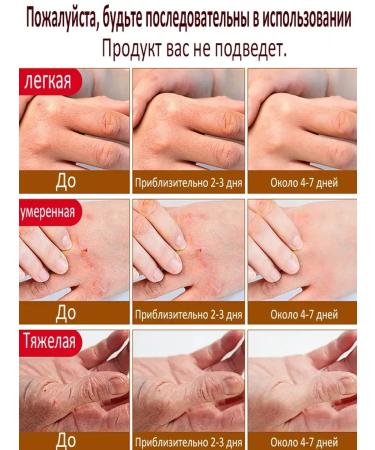 Cream from cracks on heels healing 150r - Buy Online on GoSupps.com