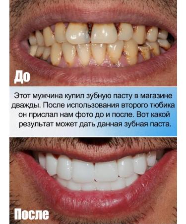 Toothpaste whitening from coffee tea and tobacco set 120 g - Buy Online on GoSupps.com