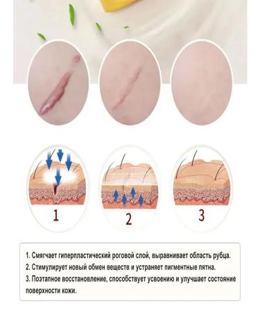 Cream gel from scars and scars of a post-acne burns on the face and body - Buy Online on GoSupps.com