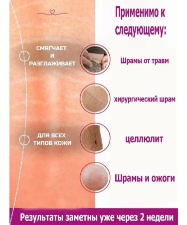 Cream gel from scars and scars of a post-acne burns on the face and body - Buy Online on GoSupps.com