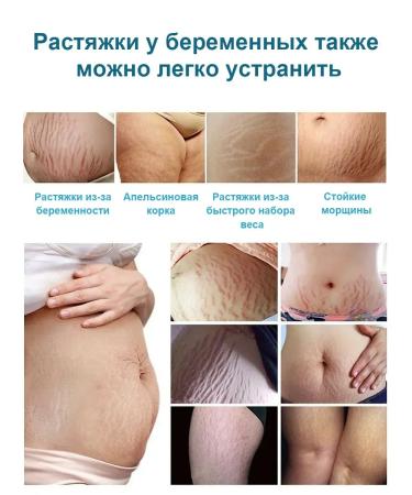 Cream gel from scars and scars of a post-acne burns on the face and body - Buy Online on GoSupps.com