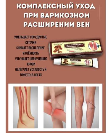 NMV Cream of huooyaotan for legs from varicose veins - Buy Online on GoSupps.com