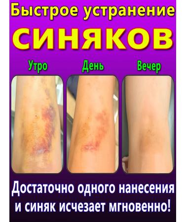 Bruise ointment and hematomas on the body 60 r - Buy Online on GoSupps.com