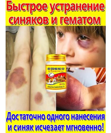 Bruise ointment and hematomas on the body 60 r - Buy Online on GoSupps.com
