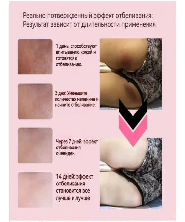 LYDIMOON Whitening cream for an intimate area and armpits - Buy Online on GoSupps.com
