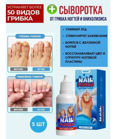 Below the baseboard Nail fungus serum for nail plate restoration