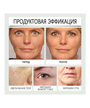Wiyun Moisturizes the cream Improve the condition of the anti -external irritants - Buy Online on GoSupps.com