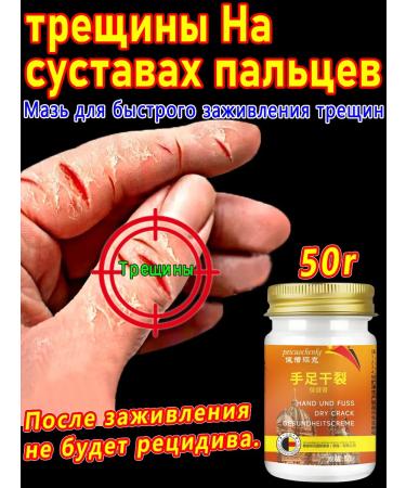 fingers on the joints of the fingers