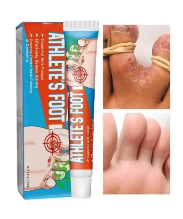 TAIS Cream from nail fungus on the legs antifungal - Buy Online on GoSupps.com