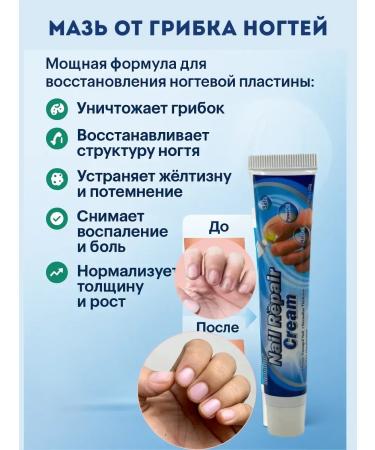 NUNA1 Fleet fungus cream