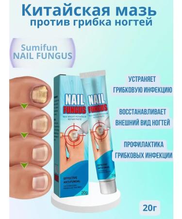 PREMIUM QUALITY N1 Chinese remedy for nail fungus antifungal cream