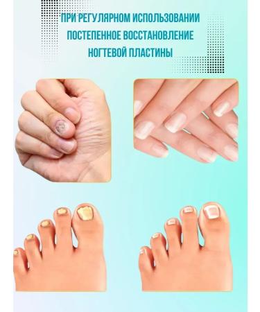 PREMIUM QUALITY N1 Chinese remedy for nail fungus antifungal cream - Buy Online on GoSupps.com