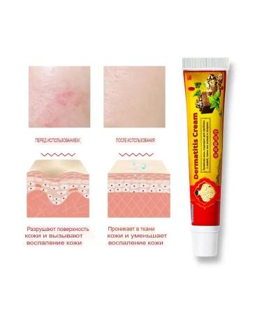 Ointment from psoriasis eczema atopic dermatitis - Buy Online on GoSupps.com