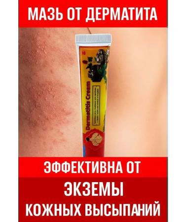 Ointment from psoriasis eczema atopic dermatitis - Buy Online on GoSupps.com