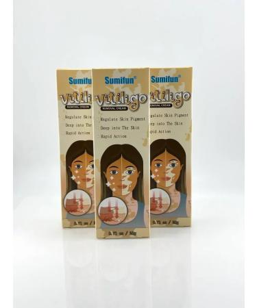 Life Vitiligo cream for the skin of the face and body Chinese set 3 pcs - Buy Online on GoSupps.com