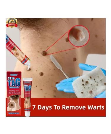 Gintensive 5 pcs. Cream from moles of papillomas and warts - Buy Online on GoSupps.com
