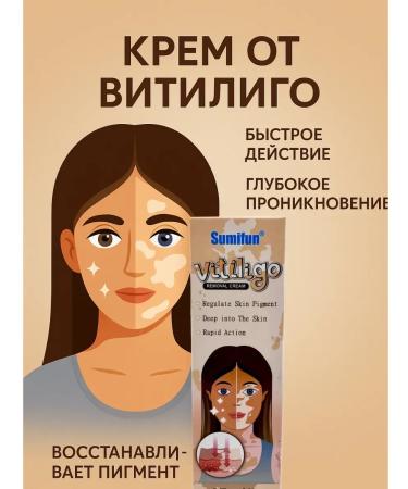 Welcome 1 Sumifun Vitiligo Cream for Face and Body 20g Skin Pigmentation Regulation