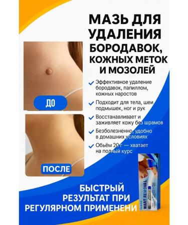 Life cream ointment from warts and papillomas from skin growths